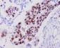 Anti-p53 TP53 Rabbit Monoclonal Antibody